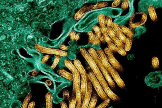 New Ebola outbreak kills 65 people in eastern Democratic Republic of Congo