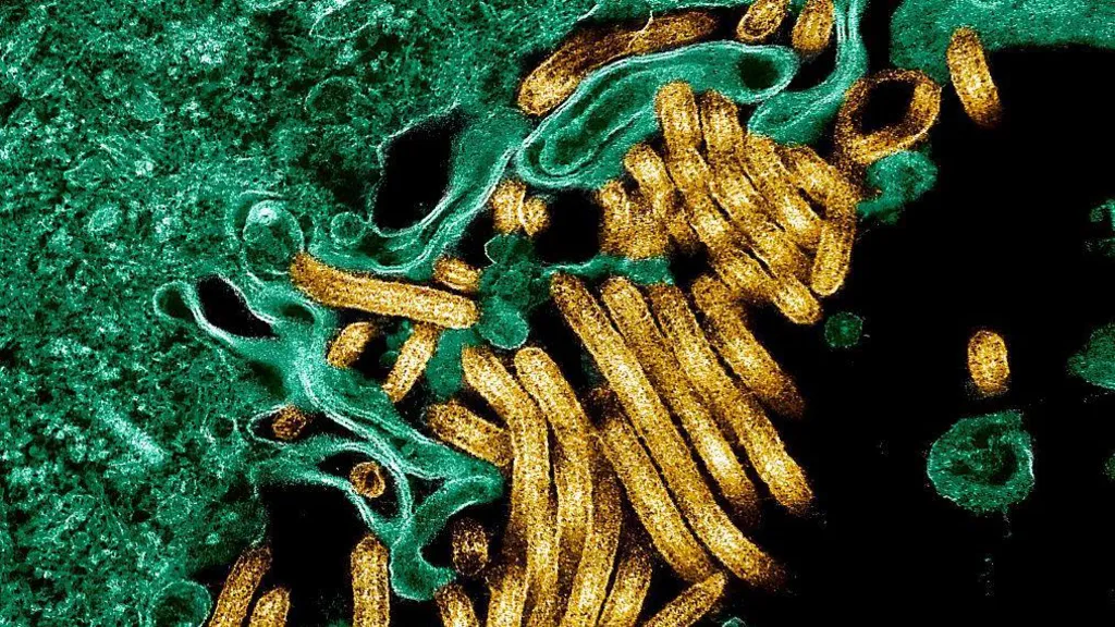 New Ebola outbreak kills 65 people in eastern Democratic Republic of Congo